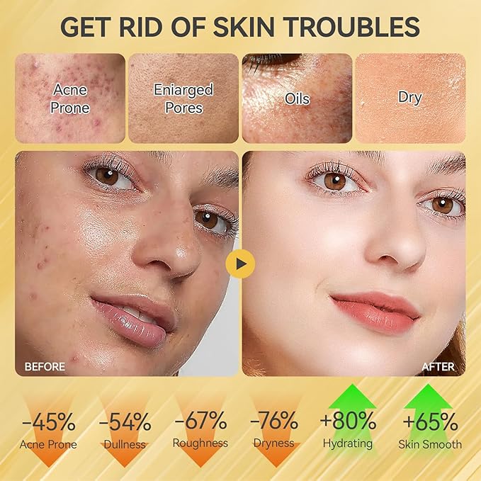 Skin Care Set, Face Snail Revitalizing Skin Care Sets & Kits, Facial Beauty Skincare Gifts for Teenage Girls with Cleanser,Toner,Serum,Eye Cream,Face Cream, Firming Hydrating Skin Care Christmas Gifts