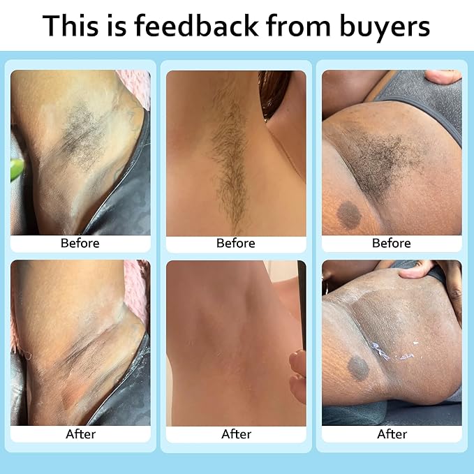 Waxing Kit for Women and Men, Wax Warmer Hair Removal at Home with Beads, Multiple Formulas Target Different Types of Sensitive Skin Body, Brazilian Bikini, Eyebrow, Facial