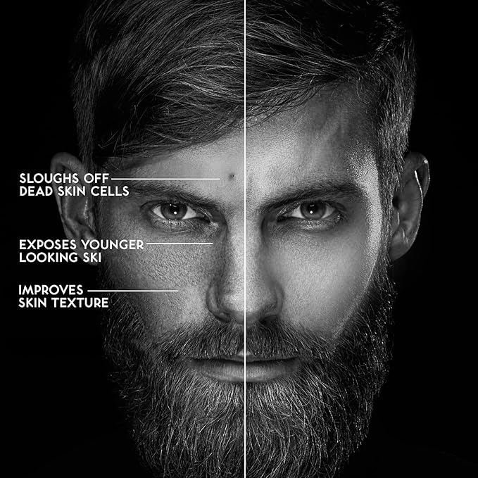 O NATURALS 100% Natural Bar Soap - Gift Set - Organic Ingredients & Essential Oils - Spa Gifts for Women & Men, Body Wash & Face Soap - 3PC Charcoal Soap