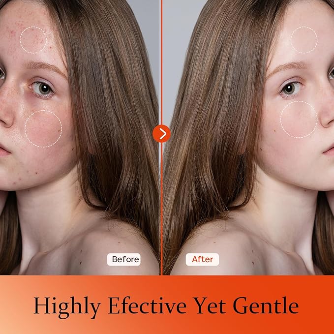 Vitamin C Serum For Face-Anti Aging & Wrinkle Facial Serum With Vitamin C,Sodium Hyaluronate,Vitamin E And More,Skin Brightening Serum For Dark Spots,Fine Lines & Dull Skin,1 Fl Oz