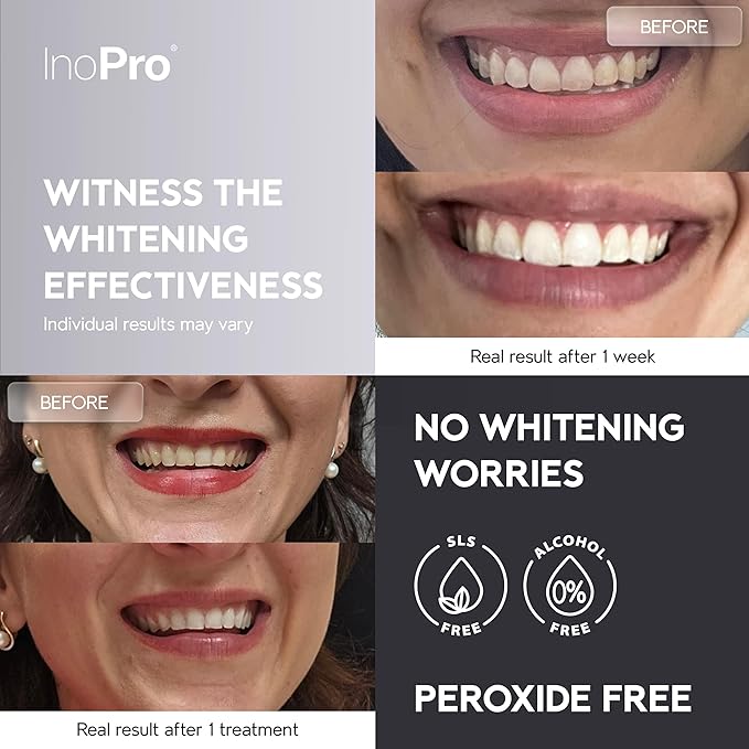 Natural Teeth Whitening Strips Kit 14 Treatments - Sensitive Teeth Whitener, Peroxide Free, Enamel Safe White Strips - Instant Teeth Whitening Without The Harm (28 Strips)