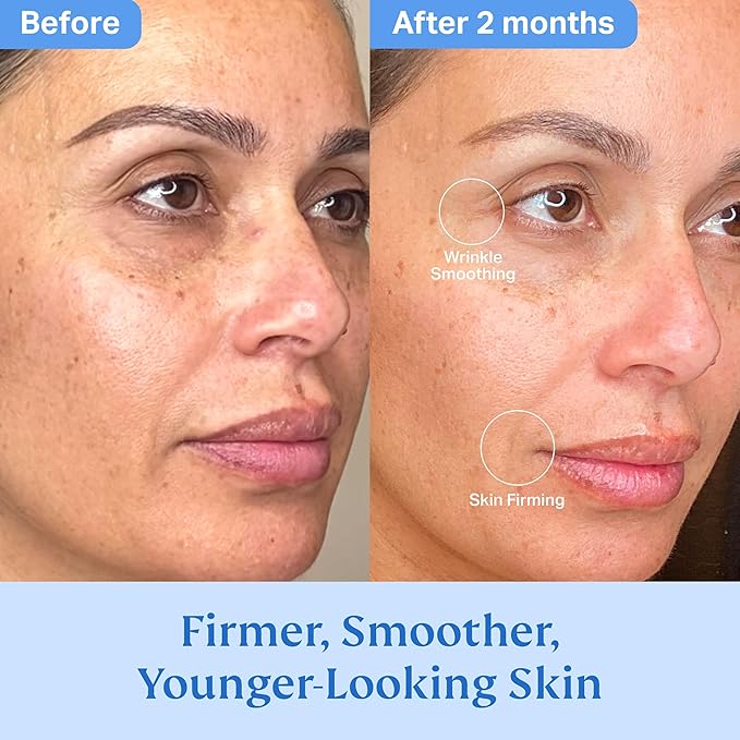 Total Rewind Sculpting Serum 1 fl oz | Line-Smoothing, Dark Spot Corrector | Vitamin C, Niacinamide, Kojic Acid, Peptides | Radiant Glow, Balanced Complexion | AM Formula