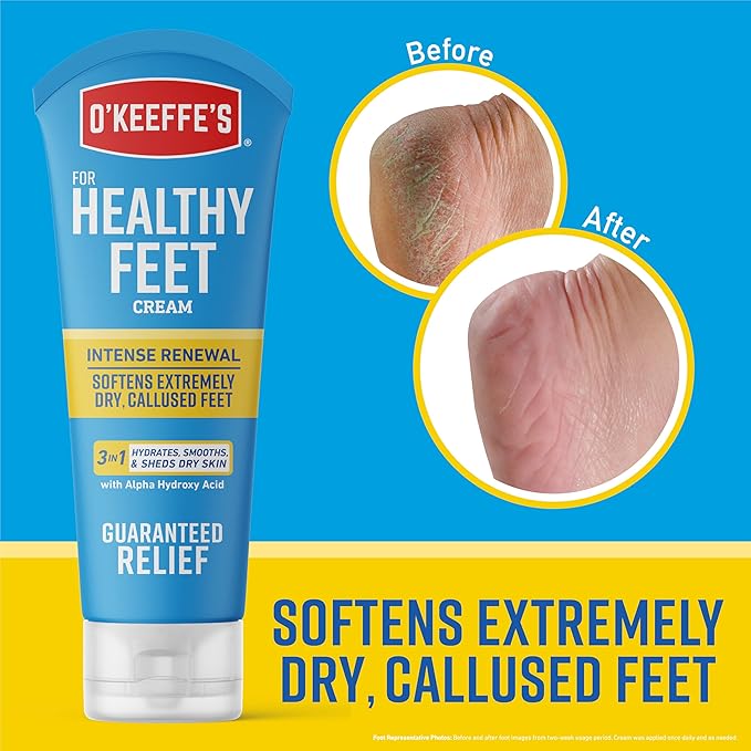 O'Keeffe's for Healthy Feet Intense Renewal Cream with Alpha Hydroxy Acid - 3 oz Tube (1 Pack) - Softens and Exfoliates Extremely Callused, Dry Feet