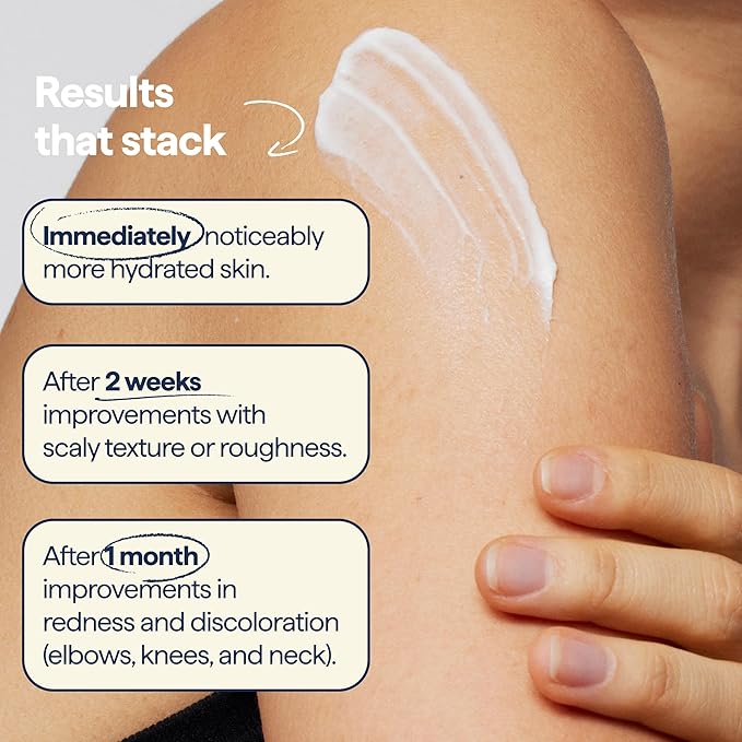 Remedy for Body Bumps – Treatment for Keratosis Pilaris (KP) and Textured, Crepey Skin with Urea, Lactic Acid, and Retinol -– Smoothing Body Moisturizer Lotion – By Dermatologist Dr. Shah