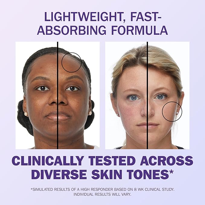 Olay Super Serum Night Repair for Face - Niacinamide, Peptide, Salicylic & Lactic Acid, Glycerin - Anti-Wrinkle, Dark Spot Reduction, Hydrating, Smooths Fine Lines, Skin Surface Renewal, 1.0 Oz