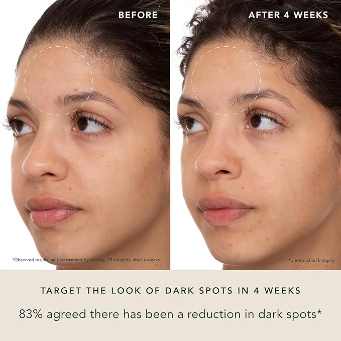 RANAVAT Brightening Saffron Face Serum - Discoloration Correcting Facial Serum, Dark Spot Corrector, Vitamin C Alternative & Hyperpigmentation Treatment - Leaves Skin with a Healthy Glow (1 oz)