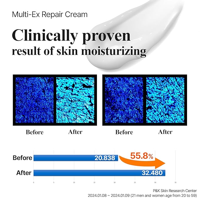 Lab for you] Multi-Ex Repair Cream 50ml/1.69fl.oz | After laser treatment cream | EGF | Soothing Moisturizing Sensitive Skin | Facial Moisturizer | Skin-Relief | Skin Repair Restore