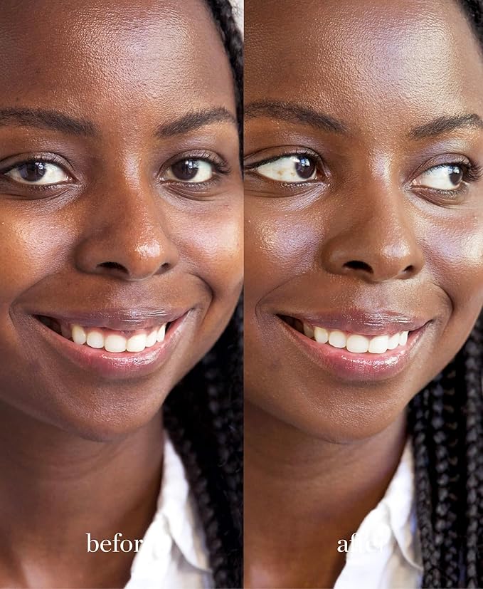 Ere Perez - Natural Arnica All-Cover Pot Concealer | Med-Full Coverage, Satin Finish, Calming, Nourishing | Vegan, Cruelty-Free, Clean Beauty (Espresso, 0.18 oz | 5 g)