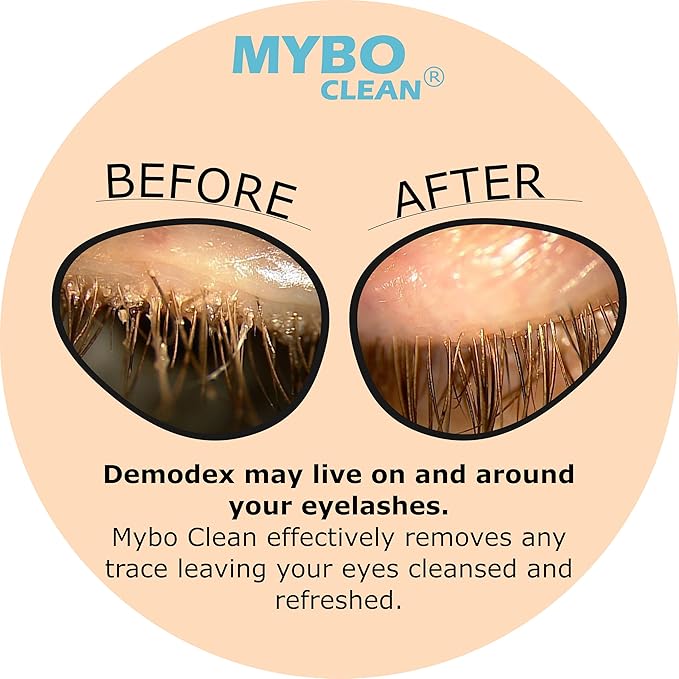Mybo Clean Eyelid Cleansing Brush for Sensitive Skin (1 Pc) + Hydrating Lids and Lash Cleansing Gel (1Pc) + Travel Bag Ideal for Gentle Cleansing of the Eyelids On the Go