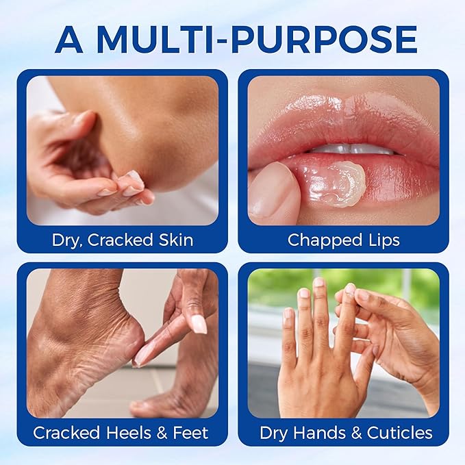 Healing Ointment, Advanced Therapy Skin Protectant, Multi-Purpose Healing Ointment and Body Moisturizer, For Dry, Cracked Skin, Minor Cuts and Burns, Soothes Cracked Hands and Chapped Lips