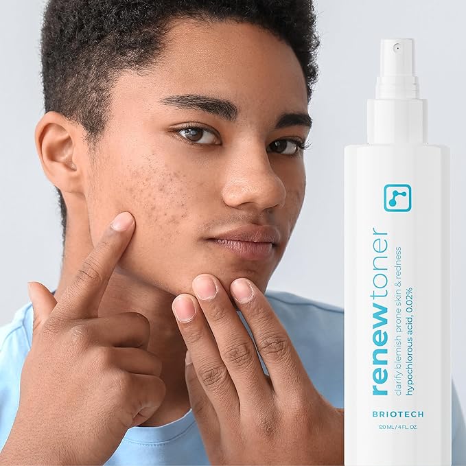 BRIOTECH Skin Renew Toner, Hypochlorous Acid Spray Topical Skin Spray for Face and Skin, Minimize Appearance of Blemishes, Soothing Mist for Redness & Bumps, Stocking Stuffer, 4 fl oz ea, 2 ct