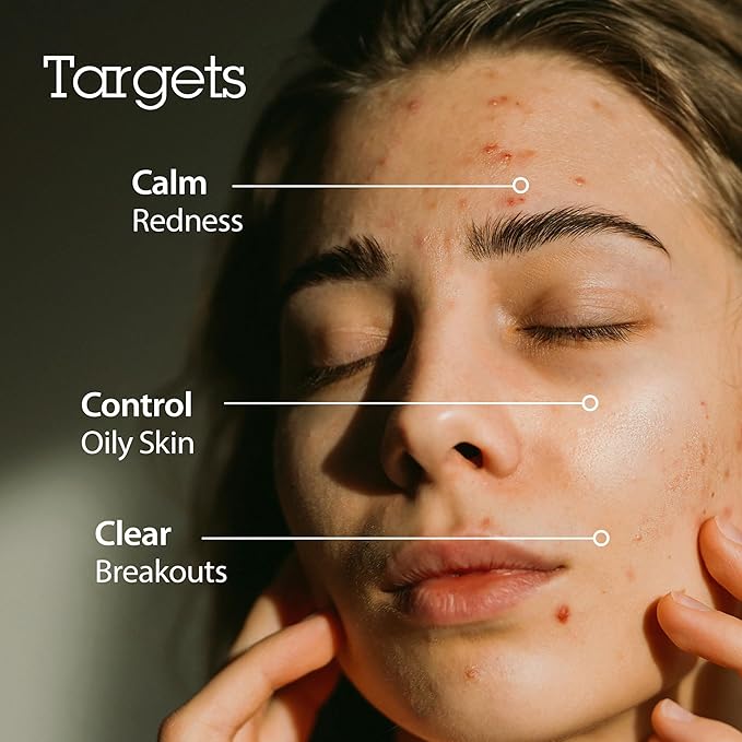 Blithe Korean Skin Care Products 6 Leaves Clear Essence for Rosacea & Redness Relief, BHA Toner Cooling Moisturizer for Face, Blackhead Treatment, Evening Primrose Wintergreen Green Tea 1.83 Oz