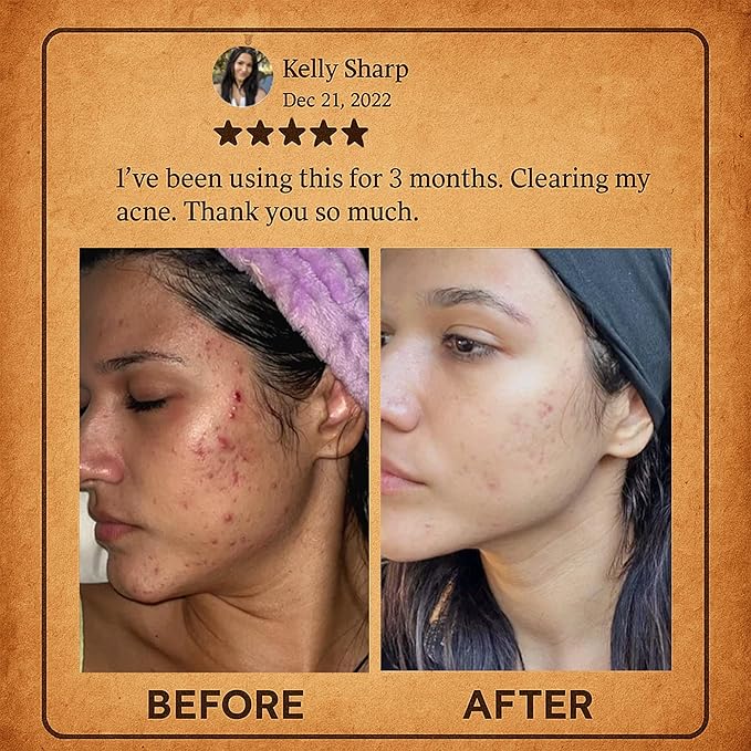 Beef Tallow Cream for Skin Care