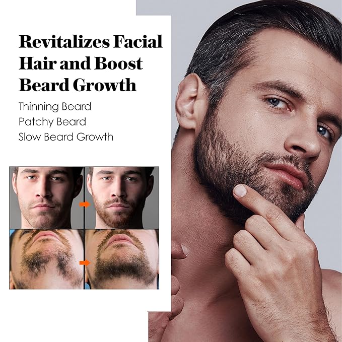 Minoxidil Beard Growth Oil: Minoxidil For Men Beard Infused With Biotin, Extra Strength Minoxidil 5% Beard Growth Serum to Grow Beard & Mustache Fast