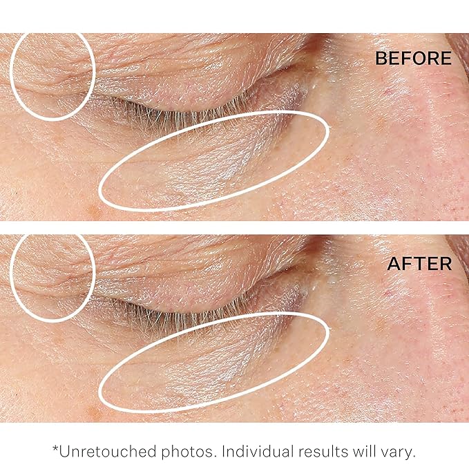 StriVectin Anti-Wrinkle Intensive Eye Cream Concentrate for Wrinkles PLUS, Targets Crow's Feet, Firmness, Puffiness & Dark Circles,White, 0.25 Fl oz (Pack of 1)