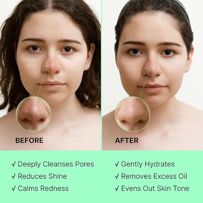 2-in-1 Green Tea Mask Stick - Blackhead Remover Mask & Hyaluronic Acid Moisturizer - Facial Deep Pore Cleanser - Face Masks for Skincare (2-pack, Tea Tree)