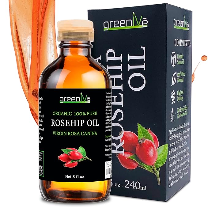 GreenIVe Organically Grown Rosehip Oil Rosa Canina 100% Pure Cold Pressed Virgin Oil Exclusively on Amazon (8 Fl Oz)