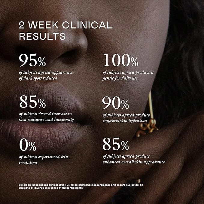 EADEM Milk Marvel Dark Spot Serum, Vitamin C Face Serum Infused with Niacinamide, Dark Spot Remover for Face & Body, Dark Spot Corrector for Skin Care, Mothers Day Gifts, 1 oz