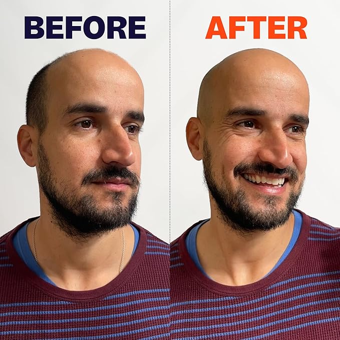 FlexSeries Electric Head & Body Hair Shaver - Mens Cordless Rechargeable Wet/Dry Skull Bald Head Back & Groin Waterproof Razor with Rotary Blades, Clippers, Nose Trimmer, Brush, Massager