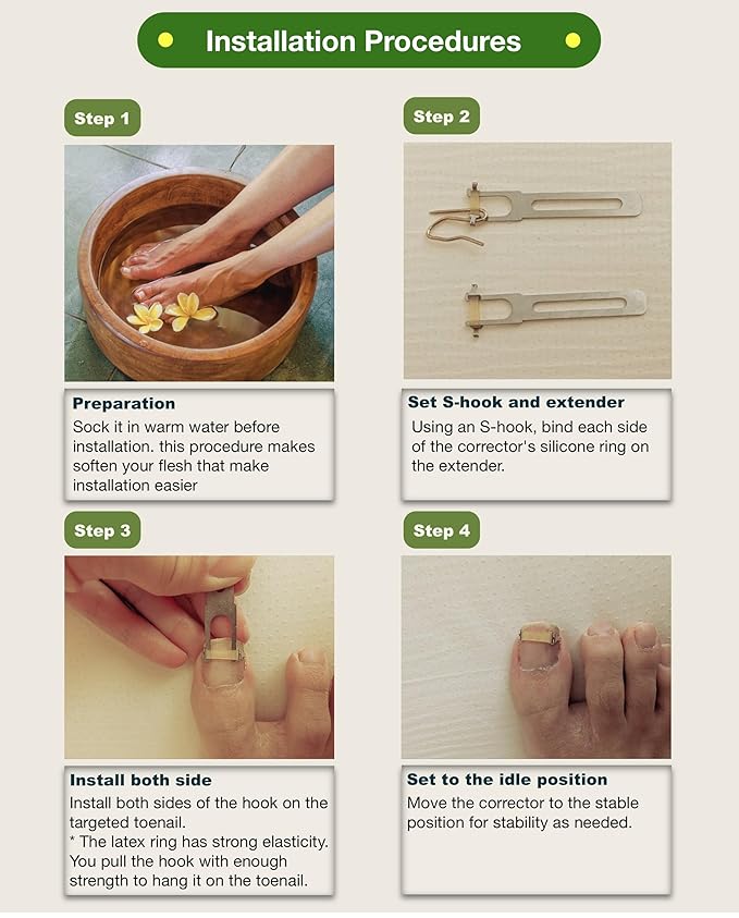 Ingrown Toenail Treatment & Corrector with Latex Elasticity - Curved Toenail Straightener | Effective Daily Solution for Ingrown Toenail Pain & Growth Correction [M/0.75inches/18-20mm]