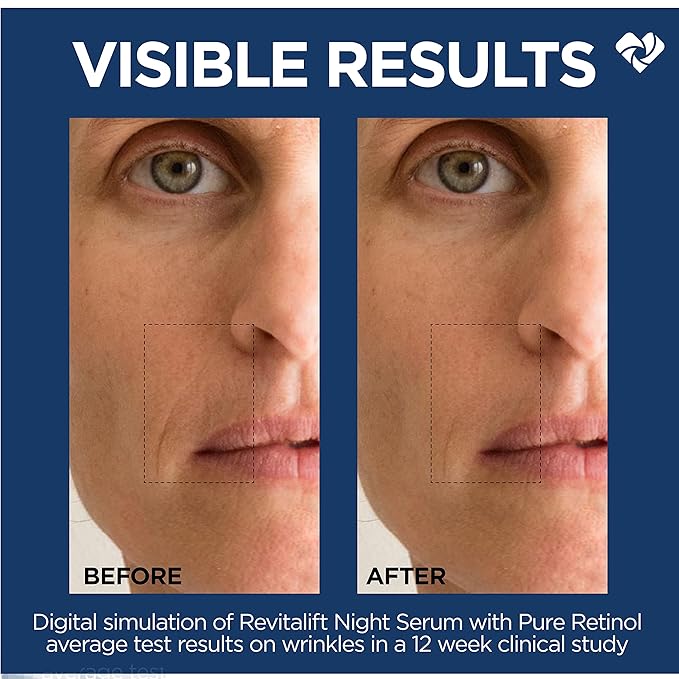 L'Oreal Paris Revitalift 0.3% Pure Retinol Night Serum, Reduce Deep Wrinkles, Fragrance Free 1 oz + Moisturizer Sample