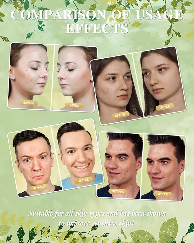 Beef Tallow for Skin - Whipped Tallow Balm with Manuka Honey, Handmade Moisturizer for Sensitive Skin (Lavender)