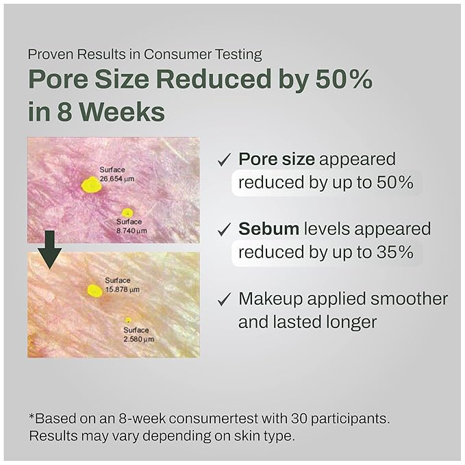 Pore Control Cleansing Gel Foam - Korean Skincare Gel to Foam Cleanser with Green Tea, Chestnut Shell, and Botanical Complex for Pore Care, Sebum Balance and Makeup Removal, 155ml / 5.24 fl.oz