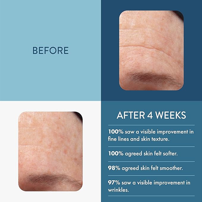 Lancer Skincare The Method Intro Kit, 3-Step Facial Exfoliator, Cleanser, and Moisturizer Kit for Oily or Congested Skin