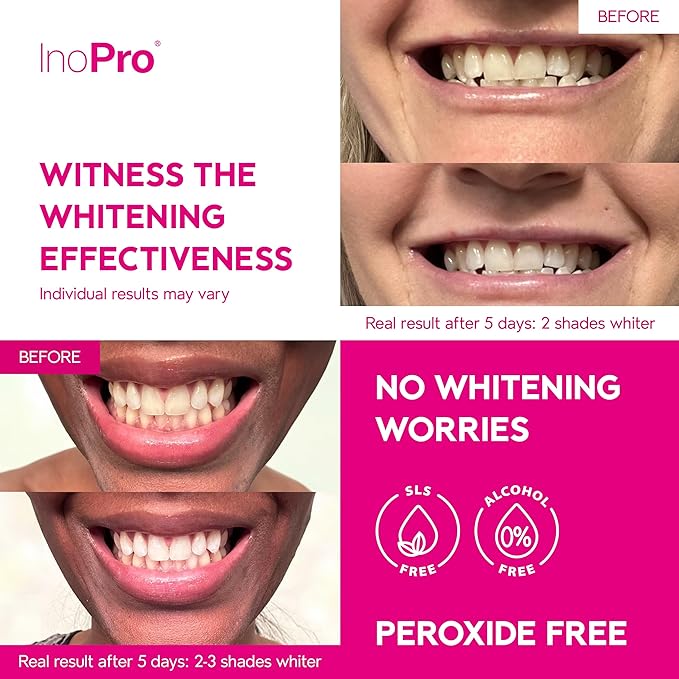 Teeth Whitening Strips 21 Treatments Kit - Teeth Whitener, Peroxide Free, Enamel Safe Green White Strips, Deep Stains Removal - Instant Teeth Whitening Without The Harm (42 Strips)