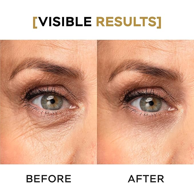 Moisturizing Night Serum w/Hyaluronic Acid, Cucumber, Grape & Coffee Extract for Dark Circles, Puffiness & Bags - Under Eye Hydration Serum for Women & Men (0.67 Fl Oz)