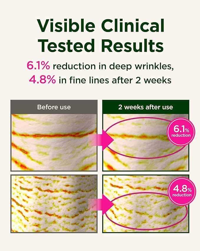 CKD Gua Sha Neck Cream [Refill] - Retinol Collagen Firming Cream for Double Chin, Neck & Jawline Lifting, Korean Skin Care without Massage Roller, 1.69 fl oz