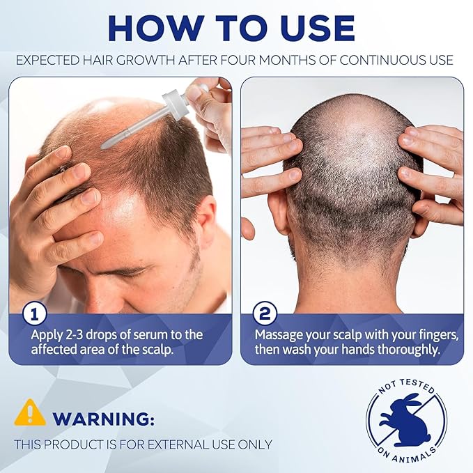 5% Minoxidil for Men and Women, Hair Regrowth Treatment for Thinning Hair and Hair Loss, Topical Solution - 3 Months Supply - Dermatologist recommended (Pack of 3)