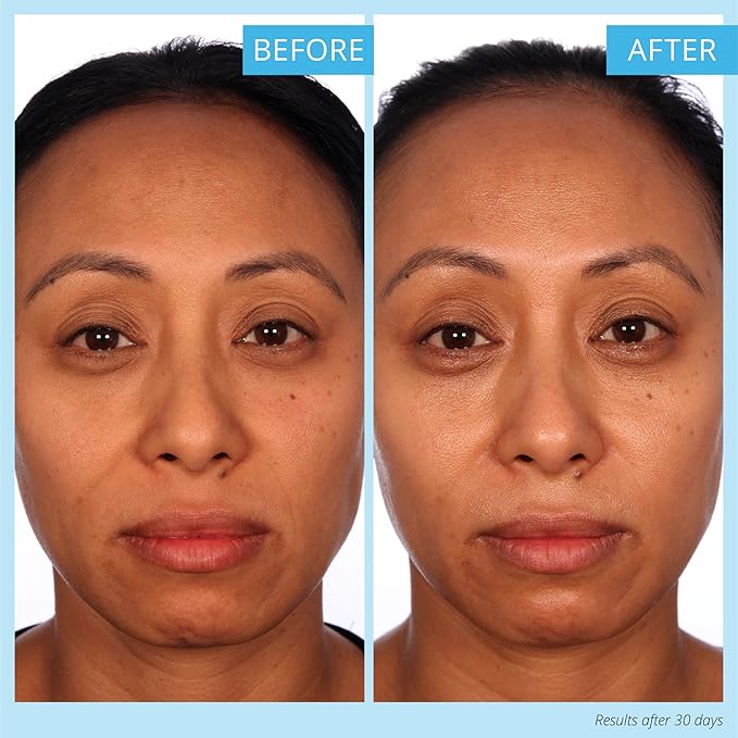 SKINN Luminous Firming Cream - Facial Skin Care Cream Improves Elasticity, Plumps and Lifts Sagging Skin-Maintains Hydration to Reduce Fine Lines,Strengthen Skin’s Barrier Function-Manuka Honey