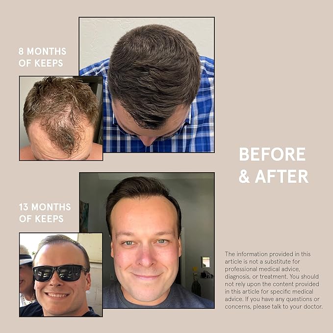 Keeps Hair Regrowth Treatment Mens Conditioner for Fuller, Thicker Looking Hair, 8 oz - Thinning and Hair Growth Conditioner for Men - DHT Blocker - Infused with Biotin, Caffeine, & Saw Palmetto