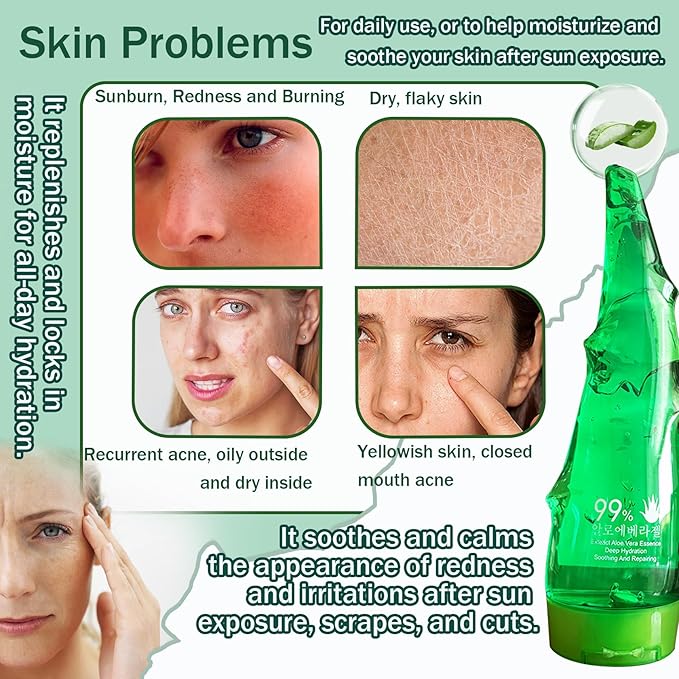 99% Purity Aloe Vera Gel - Hydrating Aloe Vera Gel for Face and Skin,No Sticky Moisturizing Aloe Gel(5 pcs) B