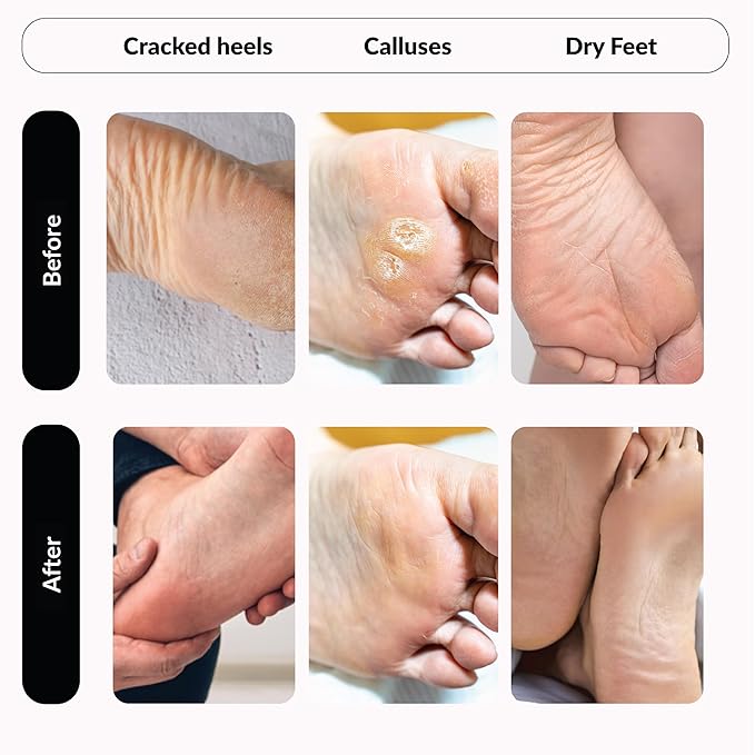 Premium Foot Mask for Men Double Pack | Exfoliating Foot Peel & Callus Remover for Feet - Repair rough heels with one-time treatment Baby Soft Feet