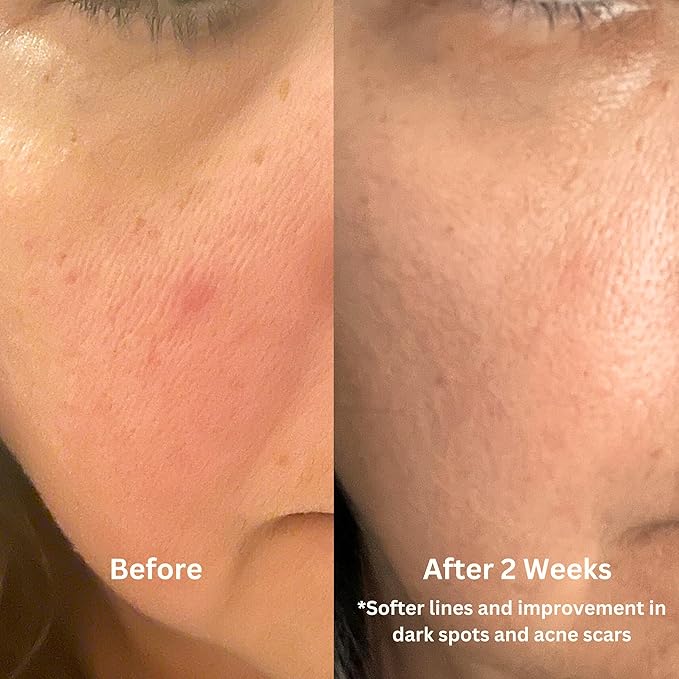 Luster Bakuchiol Retinol Alternative Face Oil For Anti-Aging, Fine Lines, Boost Glow, Antioxidant Nourishing Blend with Bakuchiol, Astaxanthin, Rosehip, Meadowfoam, Squalane, Pomegranate, Made In USA