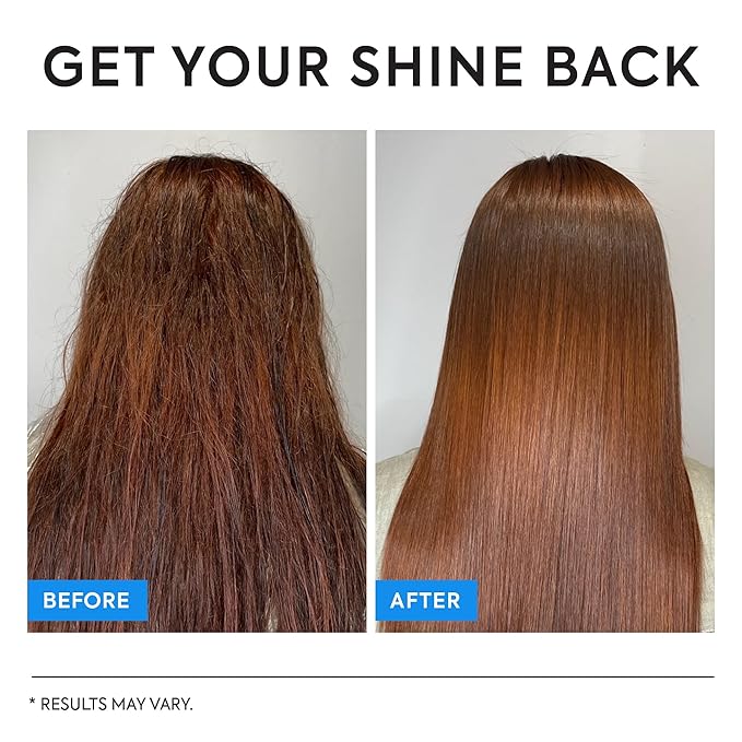 Fungal Scalp & Hair Loss Solution: Natural Therapeutic Shampoo & Conditioner Set for Psoriasis Folliculitis Itchy Bump Dandruff & Thinning Hair - Hair Growth with Rice Protein - Soothing, Sulfate-Free