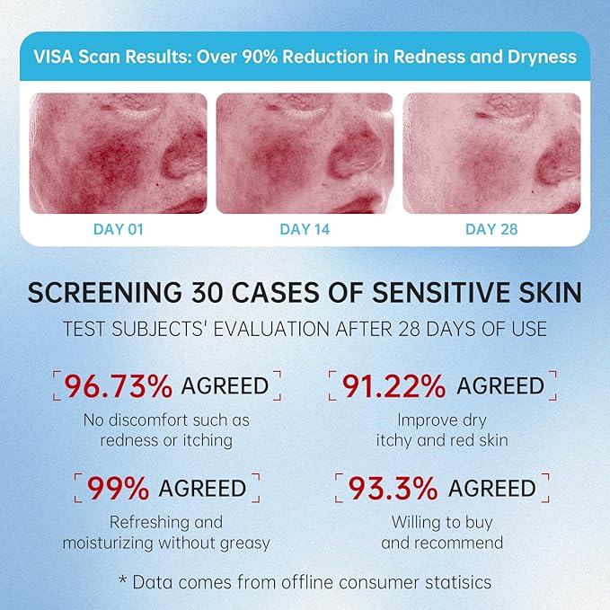 VGO Snail Mucin 92% Face Moisturizer – Anti Aging, Skin Repair & Hydrating Face Cream with Ceramide & Vitamin E, 1.76 oz