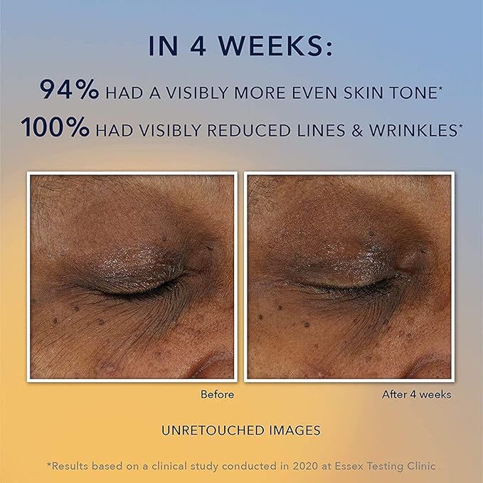 RoC Multi Correxion Revive + Glow 10% Active Vitamin C Serum for Face, Daily Anti-Aging Wrinkle and Skin Tone Skin Care Treatment, Brightening Serum, 1 Fluid Ounce