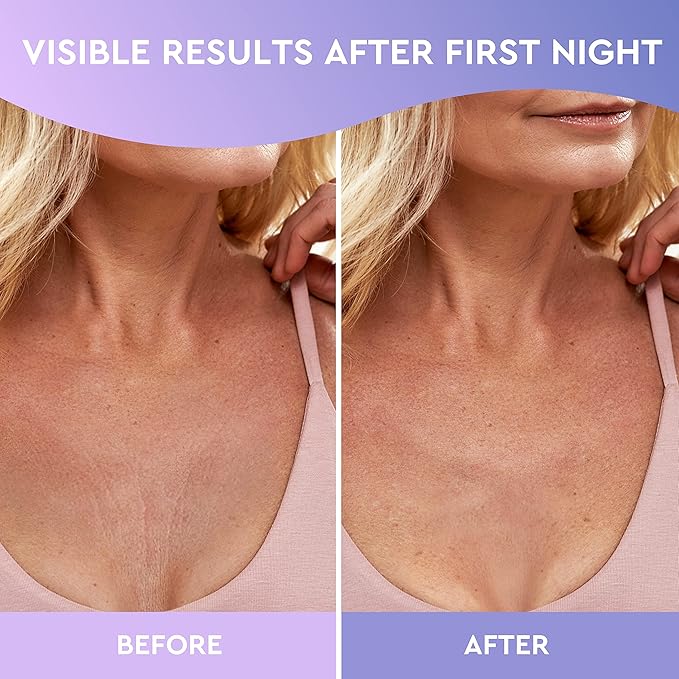 CLEVERFY Silicone Chest Wrinkle Pads for Décolleté - 4-Pack of T-Shape Reusable Anti-Wrinkle Patches