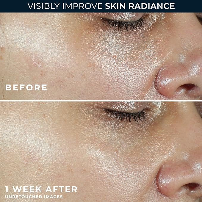 RoC Multi Correxion Revive + Glow Vitamin C Broad Spectrum SPF 30 Moisturizer (1.7 oz) with Retinol Eye Cream Packette