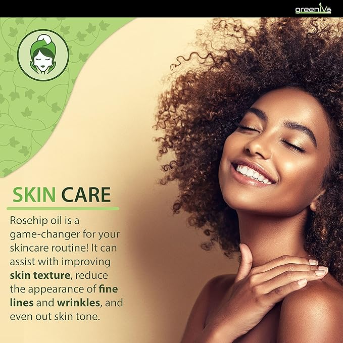 GreenIVe Rosehip Oil Rosa Canina 100% Pure Cold Pressed Virgin Oil Hair and Skin and DIY products (4oz dropper)