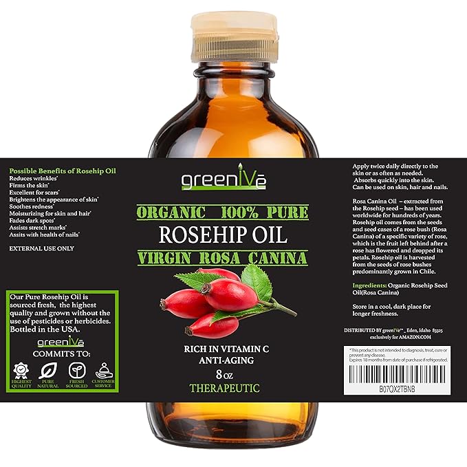 GreenIVe Organically Grown Rosehip Oil Rosa Canina 100% Pure Cold Pressed Virgin Oil Exclusively on Amazon (8 Fl Oz)