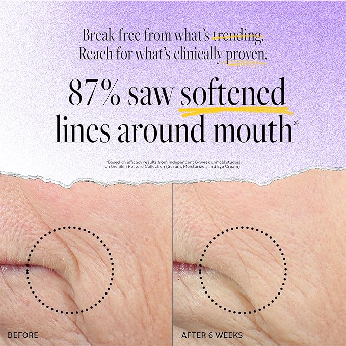 DERMA-E Advanced Peptides and Vegan Flora-Collagen Moisturizer – Double Action Collagen Face Cream with Peptide Complex – Intensely Hydrating Face Moisturizer for Lines, Wrinkles and Redness, 2 Oz