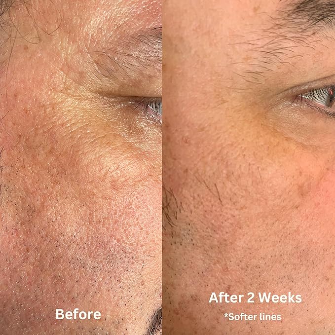 Luster Bakuchiol Retinol Alternative Face Oil For Anti-Aging, Fine Lines, Boost Glow, Antioxidant Nourishing Blend with Bakuchiol, Astaxanthin, Rosehip, Meadowfoam, Squalane, Pomegranate, Made In USA